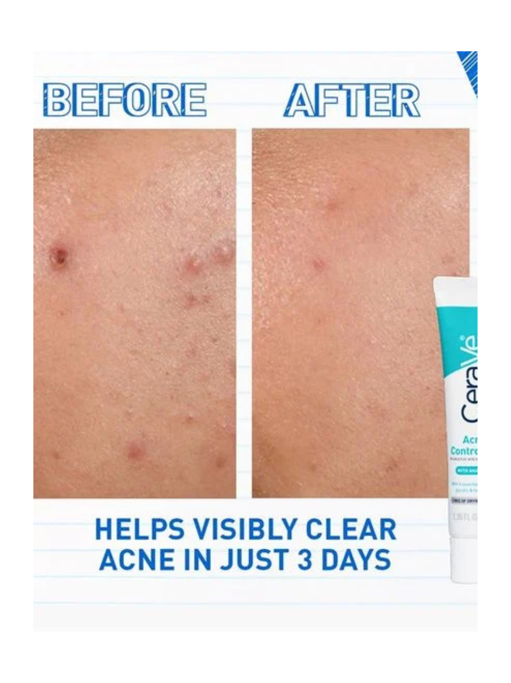 CeraVe Blemish Control Gel